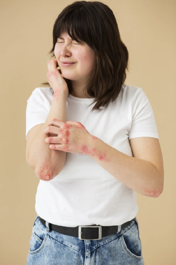 Infectitious Diseases